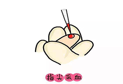 儿童91香蕉视频IOS在线微量元素的检测项目有哪些