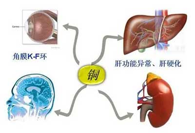 人体91香蕉视频精品数据能够准检测出但身体中微量元素铜超标会引起疾病发生